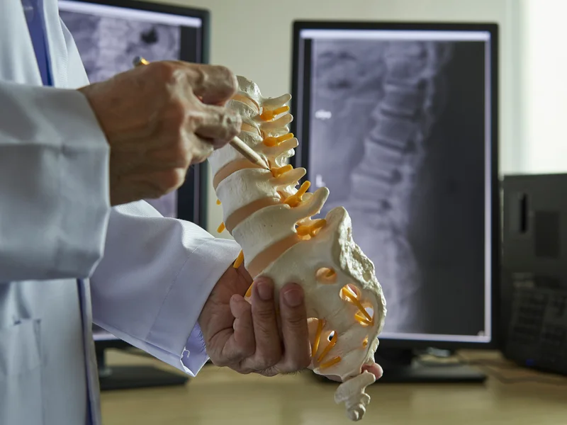 How Digital X-Rays works at Eagle Trace Spine & Sport