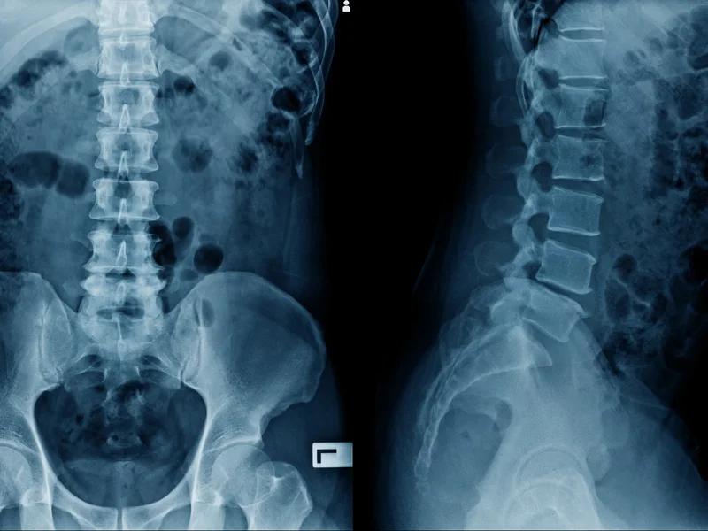 Digital X-Rays at Eagle Trace Spine & Sport in Burnsville